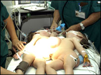 جڑواں مصری بھائی 