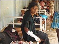 घायल बच्चे