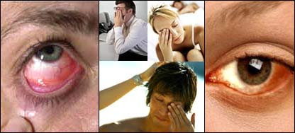 د سترګو غير مکروبي التهاب