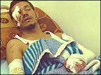 Iraquiano ferido no incidente em Falluja