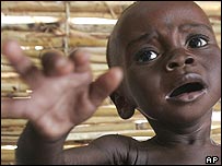 Yetersiz beslenen Afrikalı çocuk