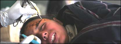 بالاکوٹ کی ایک زخمی لڑکی