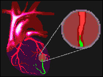 جريان خون توسط قلب
