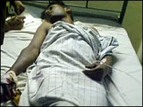 Suspect Johnson Collin Wasanthan Valentine in the hospital