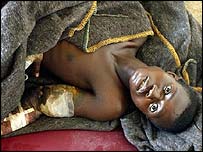 Faltam materiais médicos para tratar os feridos