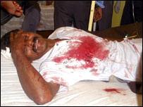 गोलीबारी में घायल व्यक्ति