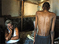 HIV virüsü taşıyan bir hasta