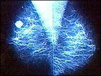 Os pesquisadores analisaram mais de um milhão de mulheres