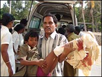 Wounded children in the air raid. (Photo from rebels)