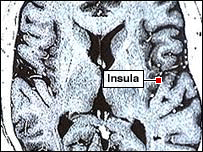 اینسولا در مغز