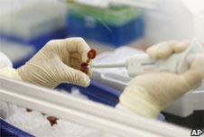 Testing for swine flu