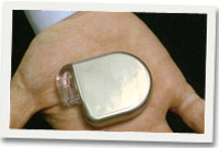 ICD (Implantable Cardioverter Defbrillator)