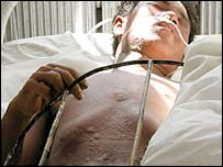 بلڈنگ میں تعمیری کام کے باعث اکیس لوگ ہلاک ہوئے ہیں