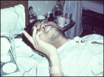 په دماغي ملاريا اخته ناروغ