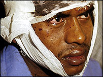 घायल व्यक्ति