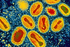 Smallpox virus