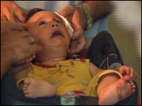 Gori dışında vurulan çocuk