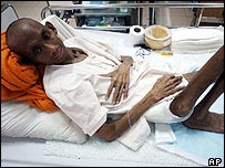 एक एड्स पीड़ित