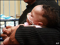 ایچ آئی وی سے متاثر بچے