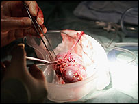 انسانی گردہ