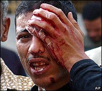 يکی از حاميان اخوان المسلمين صورت خون آلود خود را که در درگيری با پليس زخمی شده است با دست نگاه داشته است