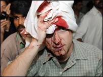 اسلام آباد دھماکہ