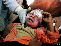 کودک مجروح در بغداد