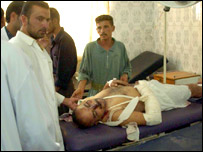 घायल व्यक्ति