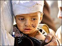 Child injured Photo - AFP/Getty Images 