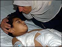 कलस्टर बम से घायल एक बच्चा