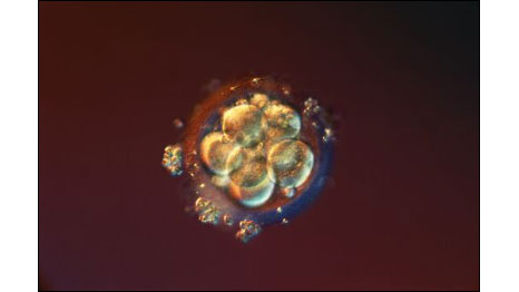 4 dias (Fotos: Lennart Nilsson)