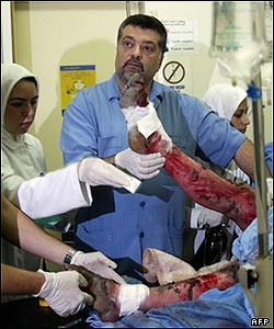 Yaralıya müdahale eden Lübnanlı bir doktor