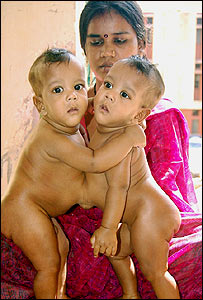 ऑपरेशन से पहले राम और लक्ष्मण