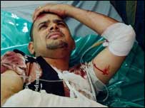 Saldırıda yaralanan bir Iraklı asker 