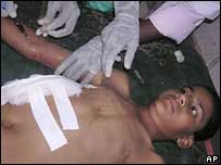 Vítima do ataque na Índia