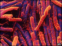 A bactéria Clostridium difficile  Foto: Science Photo Library