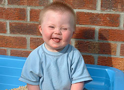 Young boy with Down's syndrome (credit: Down's Syndrome Association)