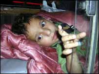 ایک زخمی بچی