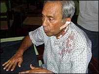 Dr. Raja John Pulle after the attack (photo: Lankaenews)