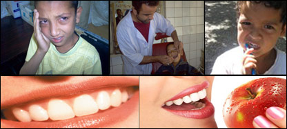 کرم خوردگی دندان