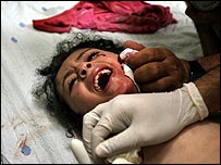 Ataque atingiu família na praia