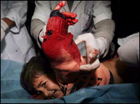 गज़ा के अस्पताल में घायल पड़ा एक बच्चा