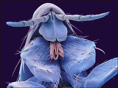 Imagem microscópica de uma pulga (Foto: Steve Gschmeissner / Science Photo Library)