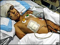 Criança atingida por bombardeio em Beirute