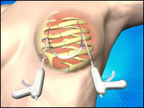 imagem de divulgação