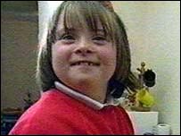 Criança com a síndrome de Down