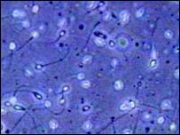 शुक्राणु