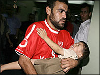 घायल बच्चा