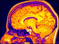 انسانی دماغ