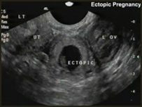 معاينات تلويزيونی 